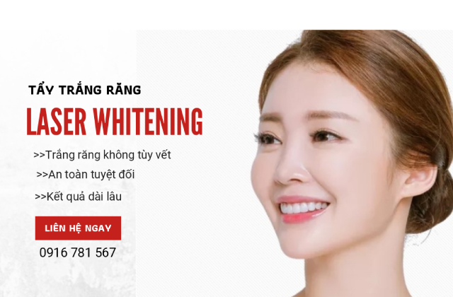 Phương pháp tẩy trắng răng laser whitening có tốt không? 