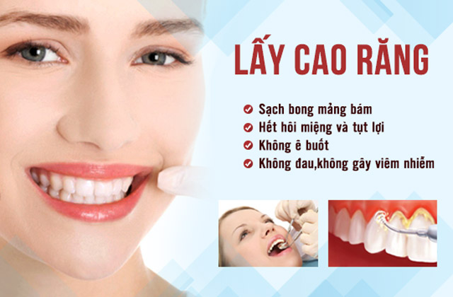 Cạo vôi răng bằng sóng siêu âm trắng, sạch không lo sâu răng 