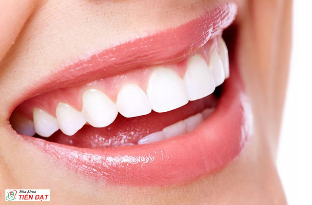 Làm răng sứ ở đâu tốt và uy tín tại TPHCM