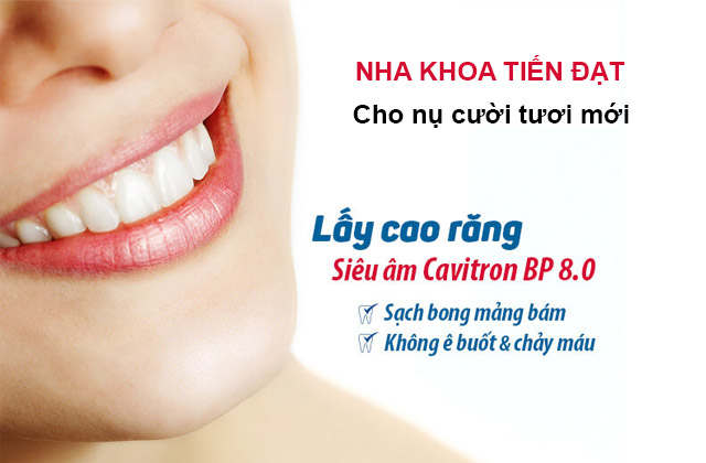 Cạo vôi răng